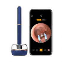 Xiaomi Bebird Note 3 Smart Ear Pick